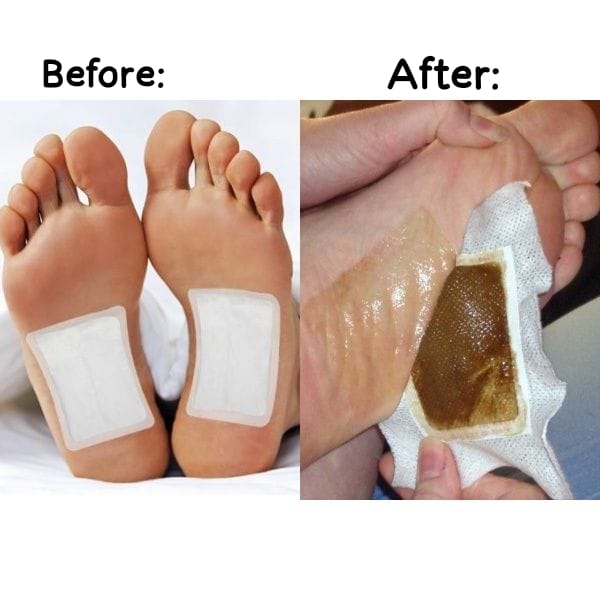 Kiyome Kinoki Detox Foot Pads – Natural Relief for Foot & Muscle Pain (10 Pcs)